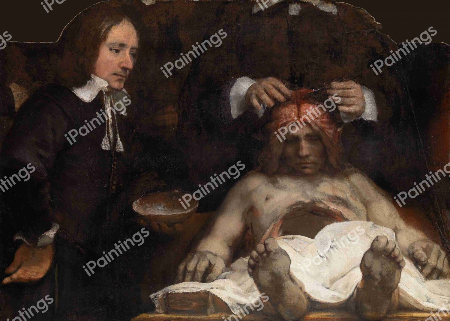 Anatomy of Doctor Deyman. The painting by Rembrandt van Rijn