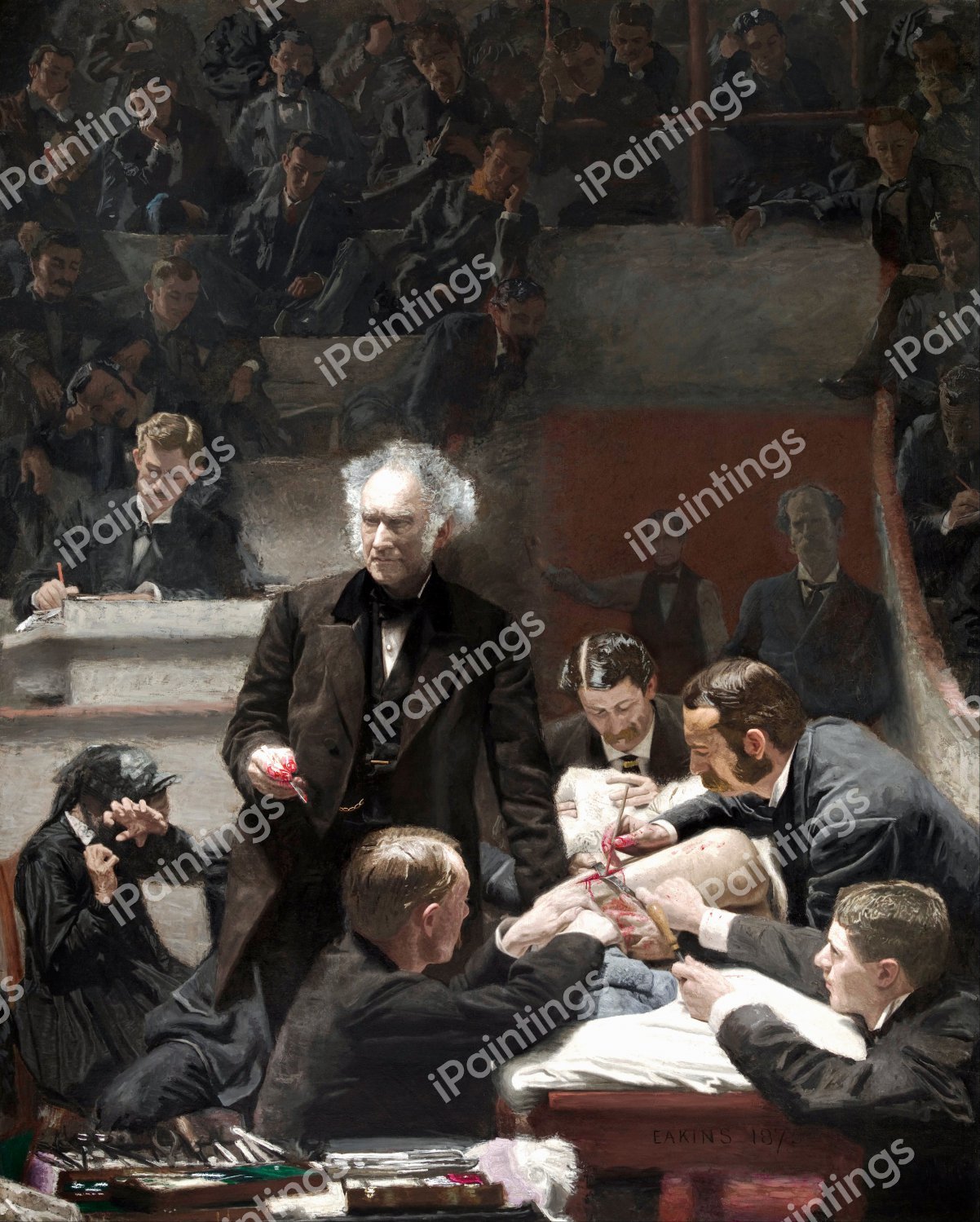 The Gross Clinic. The painting by Thomas Eakins